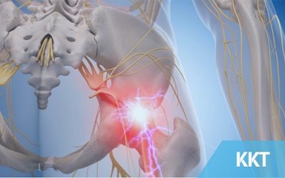 Are You Really Suffering From Sciatica??