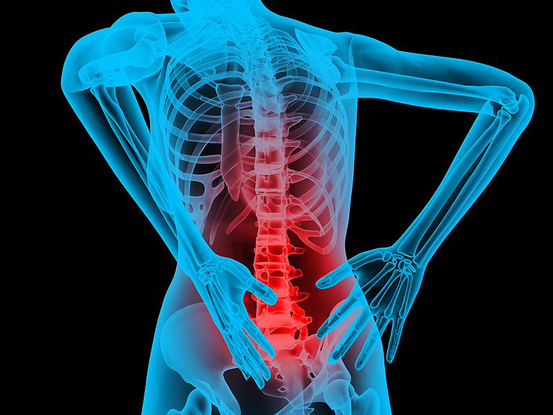 Back Pain Causes Acute Pain