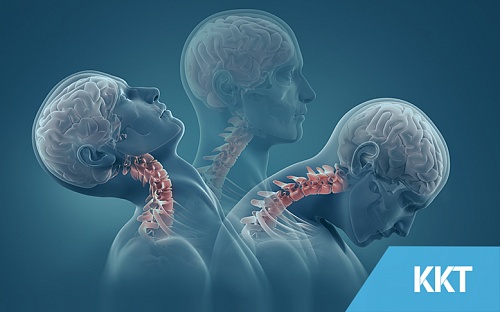 What is Whiplash? Symptoms and Prevention