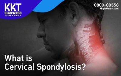Cervical spondylosis Symptoms and Causes