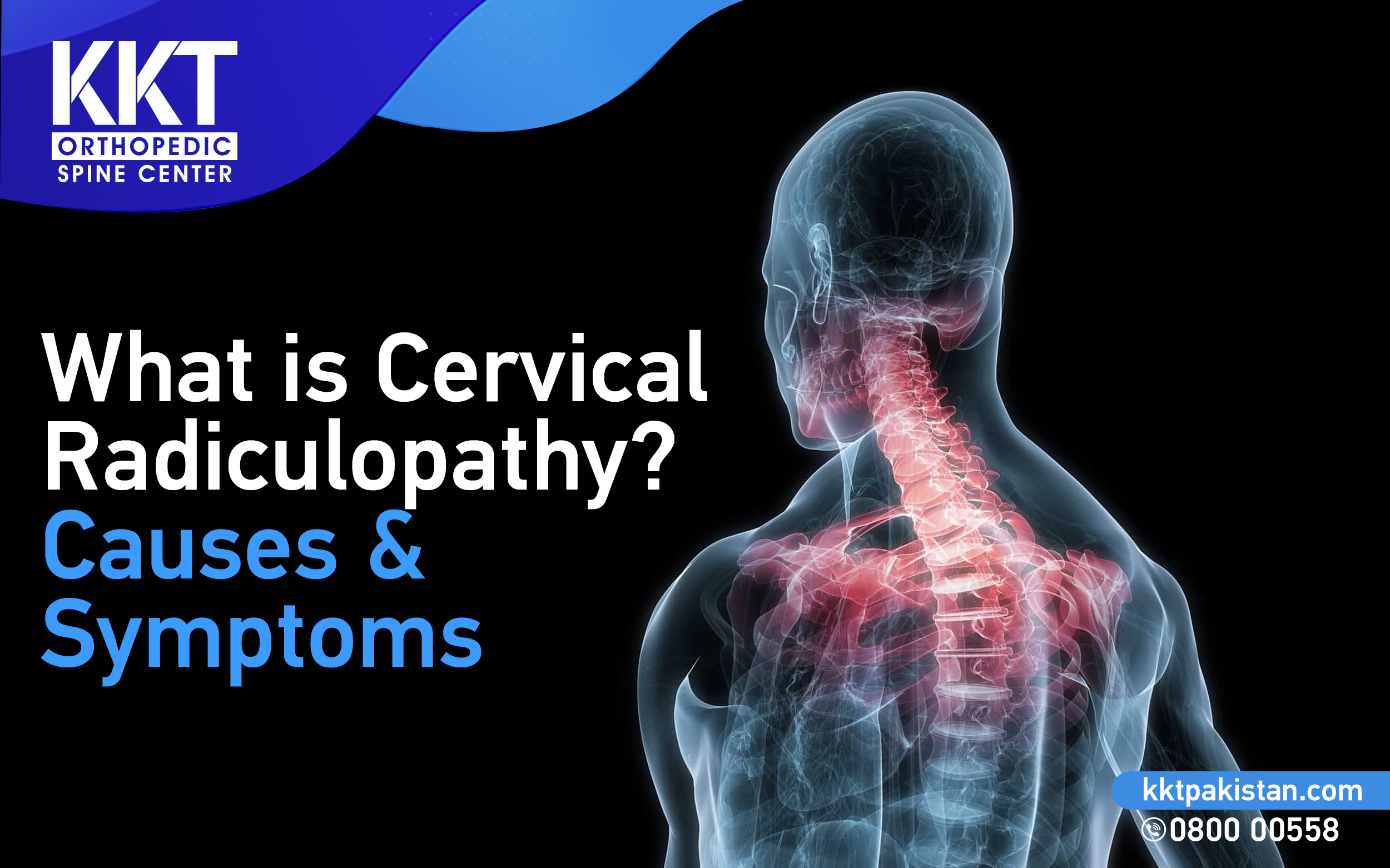 What is Cervical Radiculopathy? Causes and Symptoms - KKT Pakistan