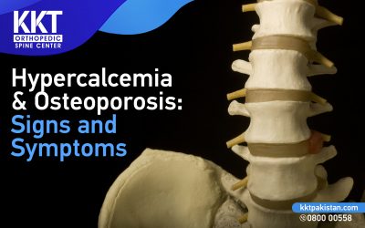 Hypercalcemia & Osteoporosis: Signs and Symptoms