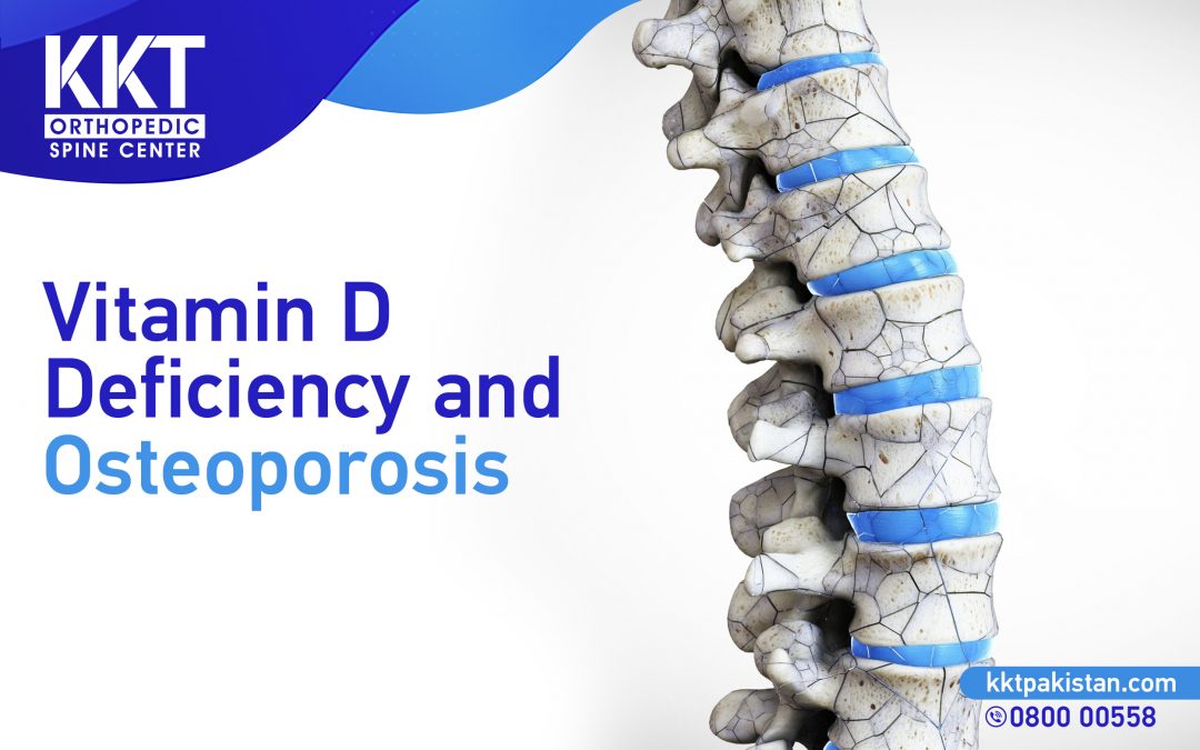 Vitamin D Deficiency and Osteoporosis