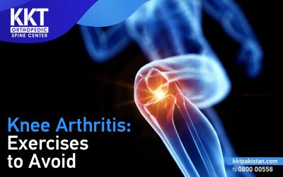 Knee Arthritis: Exercises to Avoid