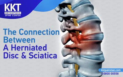 The connection between a herniated disc and sciatica: