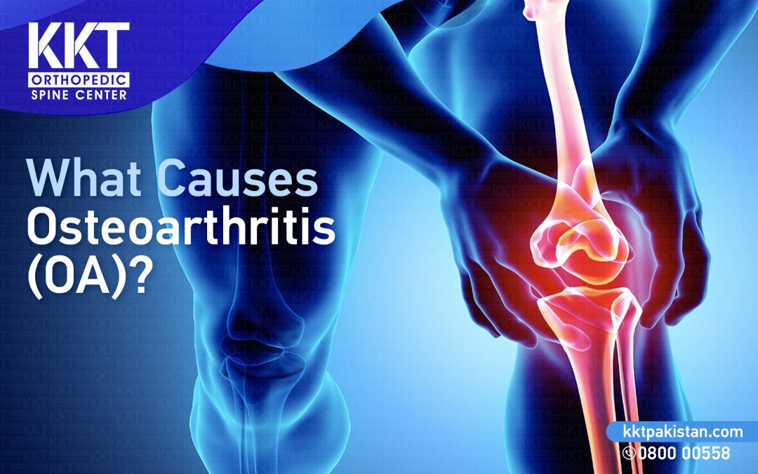 What causes Osteoarthritis?